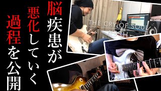 【時系列】日を追うごとに悪化！局所性ジストニアでギタリストの指が自由に動かなくなっていく様子をお見せします