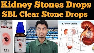 SBL Clear Stone Drops Review In Hindi. गुर्दे की पथरी की होम्योपैथिक दवा. The Mahafuzur Homeopathy.