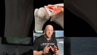 Shoulder Separation Ac Joint Dislocation Shorts