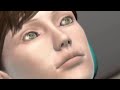 Balloon Sinuplasty (3d Animation) #shorts