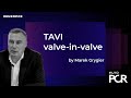 EuroPCR 2021 - Focus on TAVI valve-in-valve