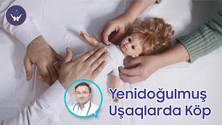 Yenidoğulmuş uşaqlarda Köp | Uşaq Həkimi Kənan Qarayev