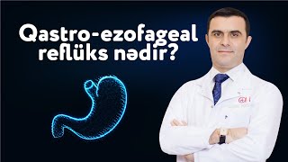 Qastro-ezofageal reflüks nədir? | Dr. Aqil Ağakişiyev