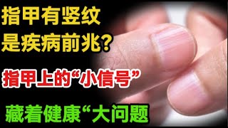 指甲有竖纹是疾病前兆？指甲上的“小信号”，藏着健康“大问题#健康Life #漲知識 #健康 #健康科普 #中老年健康 #疾病 #疾病預防 #健康飲食 #飲食健康