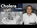 الكوليرا / Cholera