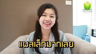 รีวิวเสริมหน้าอกกับหมอเติ๊ด แผลเล็กมาก ไม่เจ็บเลย I Review THE CLASS