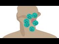 What is T-cell lymphoma