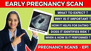 Early Pregnancy Scan (6-8 weeks scan) - What to expect & Why is it so important ?