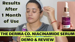 The Derma Co. Niacinamide Serum Demo \u0026 Review | How To Use Niacinamide Serum For Acne Pimple Marks