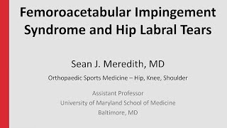 Femoroacetabular Impingement Syndrome and Hip Labral Tears