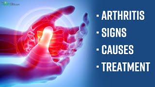 World Arthritis Day 2022: What Are The Early Signs Of Arthritis, Expert Speaks