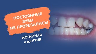 Постоянные зубы не прорезались. Истинная адентия.