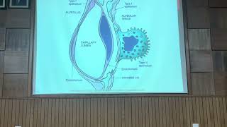 RS-Patho Lec1-Atelectasis