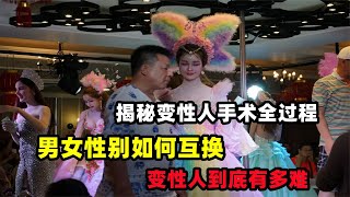 揭秘變性人手術全過程：男女性別如何互換？變性人到底有多難？