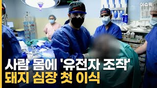 사람 몸에 '유전자 조작' 돼지 심장 첫 이식 [이슈픽]