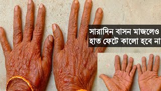 শীতে হাত ফেটে কালো হবে না, হাতে হাজা,নখে গর্ত, ছাল উঠবে না, সারাদিন কাজ করলেও হাত থাকবে নরম।