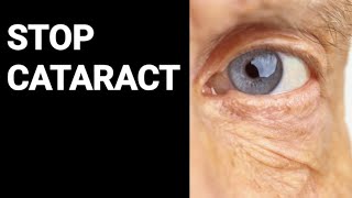 5 Steps to Slow Cataract Growth (Before It Steals Your Vision!)