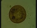 arcella testate amoeba