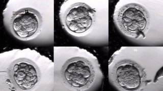 IVF PROCESS STEP BY STEP (In Vitro Fertilisation): Embryo cultivation