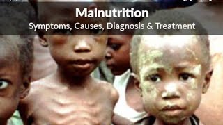 MALNUTRITION,OVERNUTRITION, OBEISITY AND CONTROL ▶️പോഷകാഹാരക്കുറവ്, അമിത പോഷണം, അമിതവണ്ണം