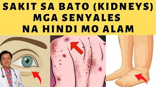 Sakit sa Bato : Unang Senyales Na Hindi mo Alam. -By Doc Willie Ong (Internist and Cardiologist)