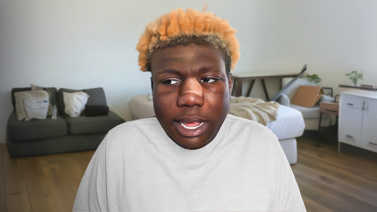 I Got Face Surgery Youtube