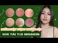 NHỮNG HIỆN TƯỢNG THƯỜNG GẶP KHI TÁI TẠO MQSKIN !!!