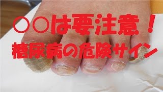 【衝撃】糖尿病の危険信号がコチラ！この症状が出たら要注意！糖尿病にならないための予防法とは!?