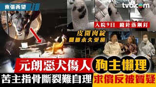 東張西望｜元朗惡犬傷人狗主懶理 苦主指骨斷裂難自理 求償反被質疑