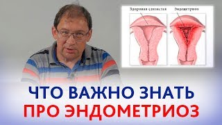 ЭНДОМЕТРИОЗ. Что ВАЖНО ЗНАТЬ про эндометриоз.