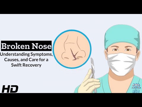 What bones are involved in a broken nose?