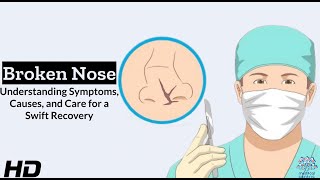 Broken Nose  Understanding Symptoms, Causes, and Cures 1080p 231026