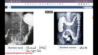 L5 Radiology: contrast media ( psychicatry , CL.p and Radio ) 42