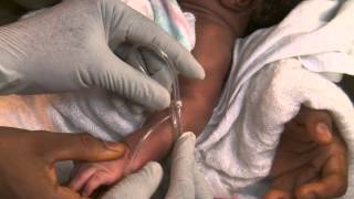 Newborn Care Series: Inserting an IV