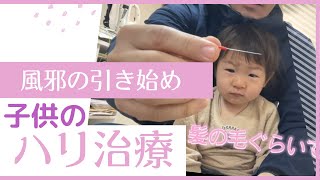 咳がひどく、花粉症！2歳息子は朝起きたら目が痛くて目ヤニいっぱい。花粉症と風邪退治で鍼治療していきましょう