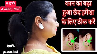 Ear Hole Closing Without Surgery In Hindi/Kaan Ke Ched Ko Kaise Chhota Karen