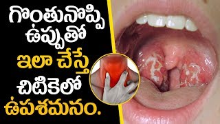 Home Remedies For Throat Pain || ఇలా చేస్తే చిటికలో గొంతు నొప్పి మాయం.