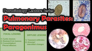 PULMONARY PARASITES (Part 1 of 3) - PARAGONIMUS