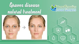 graves disease eyes treatment | graves disease treatment | graves disease eyes natural treatment