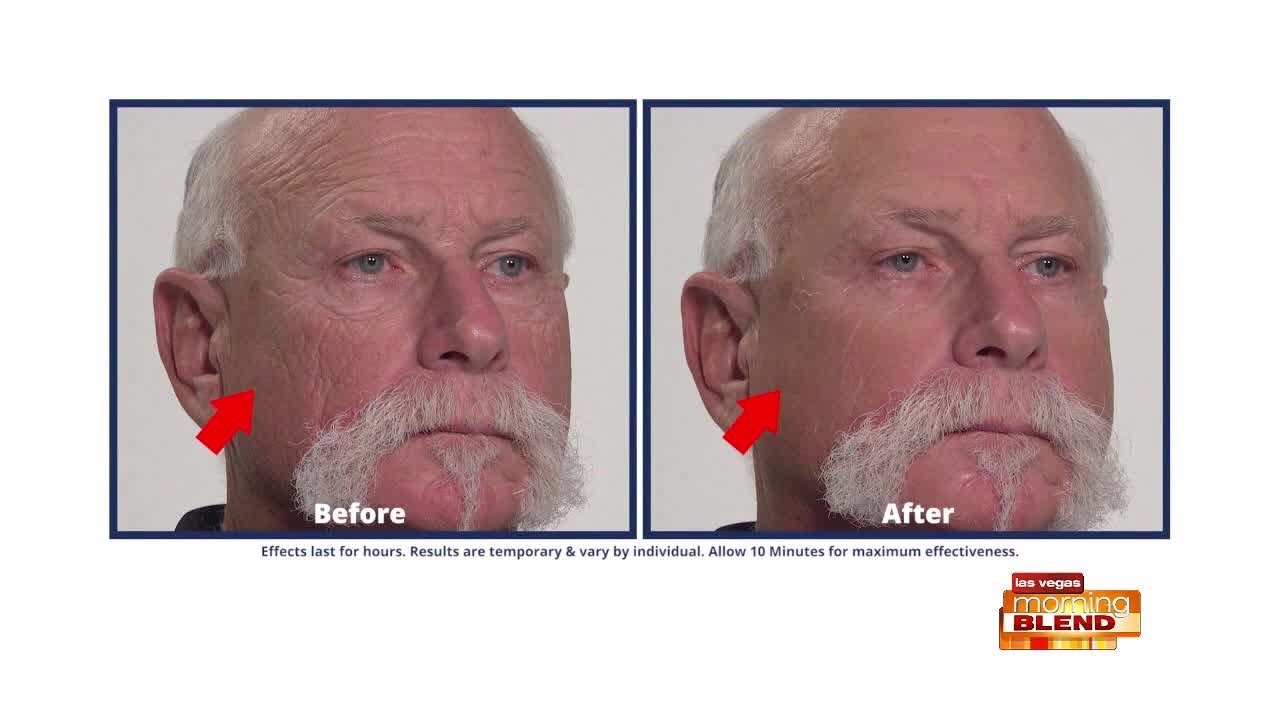 Reduce Wrinkles Look Younger Youtube