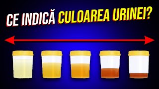 Ce indică Culoarea Urinei? Și Culoarea care Indică Moartea Rinichilor...