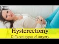 Hysterectomy - Different types of surgery - Dr  Shanthala Thupanna