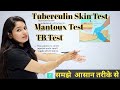 Tuberculin Skin Test | Mantoux Test |  Mantoux Test in hindi | TB Test