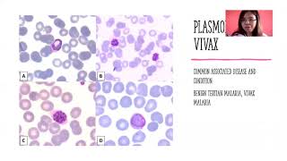 CLIN. PARASITOLOGY FINALS LECTURE # 4 : SELECT SPOROZOITES: PLASMODIUM AND BABESIA