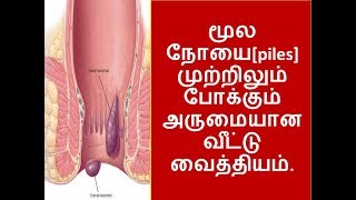 மூலநோயை முற்றிலும் போக்கும் அருமையான வீட்டு வைத்தியம்.-Home remedies for Piles.