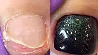 5 Incredible feet Transformation || pedicue ideas 2020