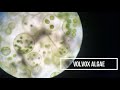 Microscope view: Volvox algae