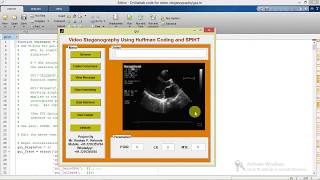 Matlab Code Video Steganography Using Image Processing