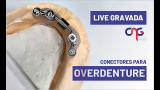 (LIVE GRAVADA) CONECTORES PARA OVERDENTURE