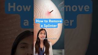 How To Remove a Splinter